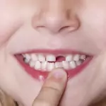 Падане на зъби