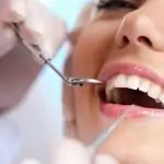 Пародонтоза и зъбен камък