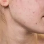 Обриви по тялото