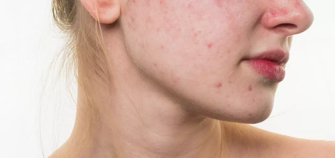 Обриви по тялото