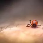 Изваждане на кърлеж