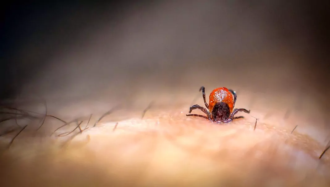 Изваждане на кърлеж