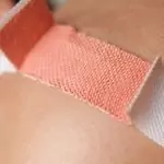 Инфектирани рани