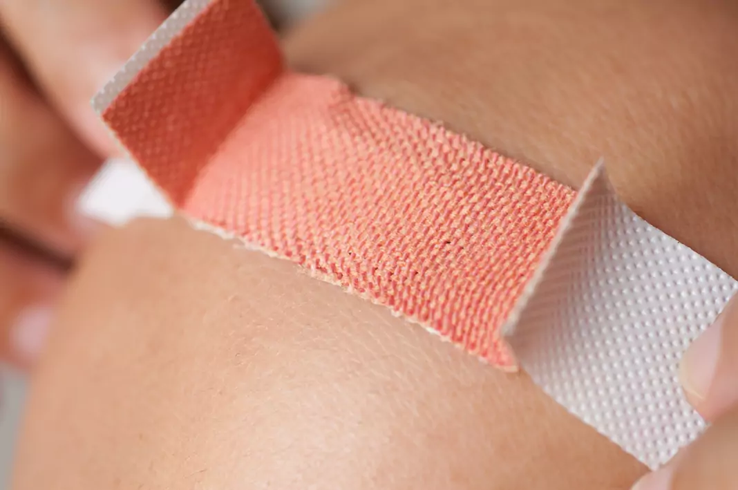 Инфектирани рани