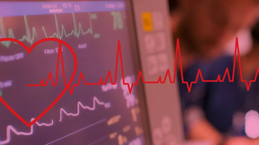 Прединфарктни състояния