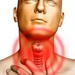 Базедова болест