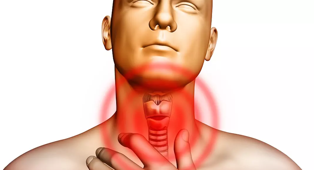 Базедова болест