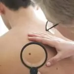 Струпеи по кожата