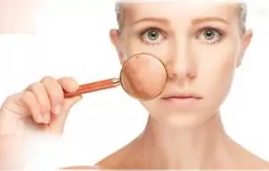 Пигментни петна