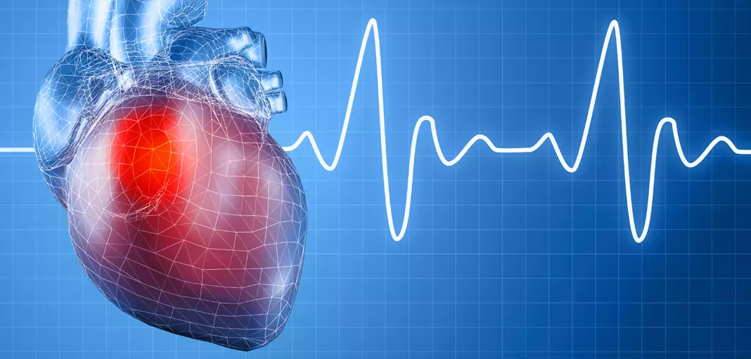 Сърцебиене