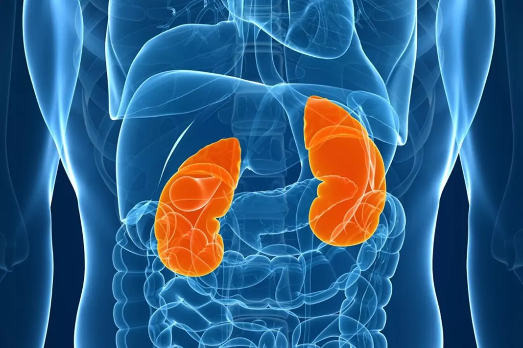 Камъни в бъбреците