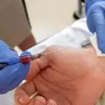 Пречистване на кръвта