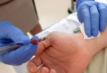 Пречистване на кръвта