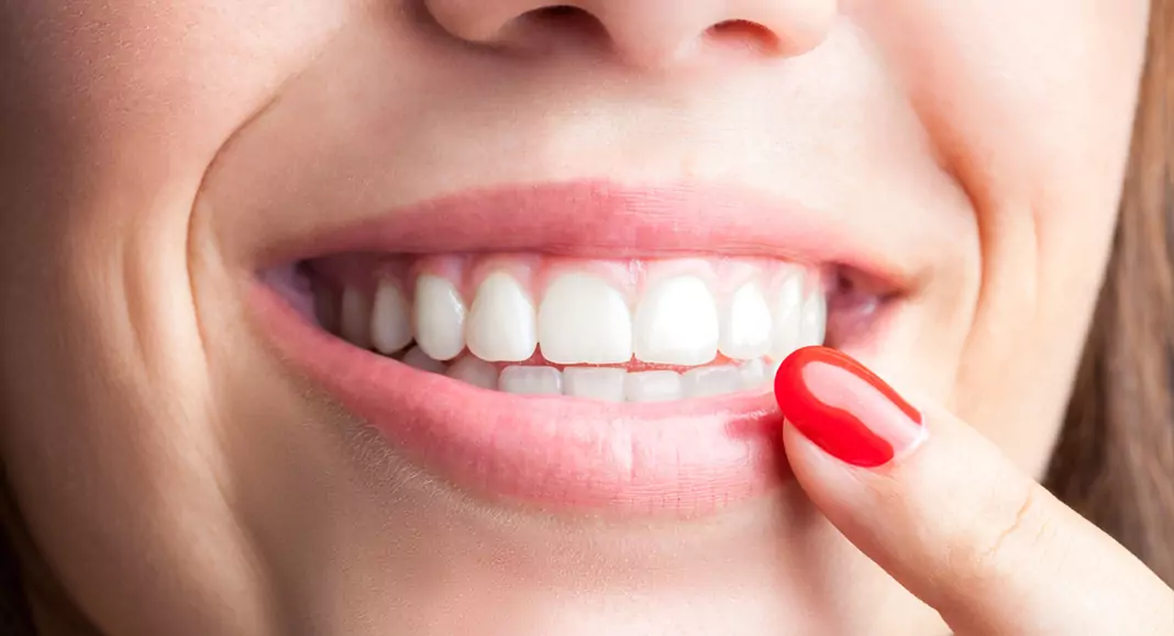 Оток от болни зъби