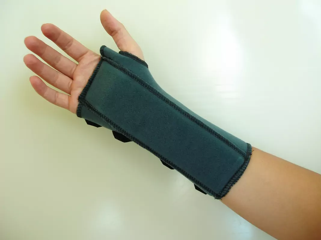 Навяхване или изкълчване на крайници