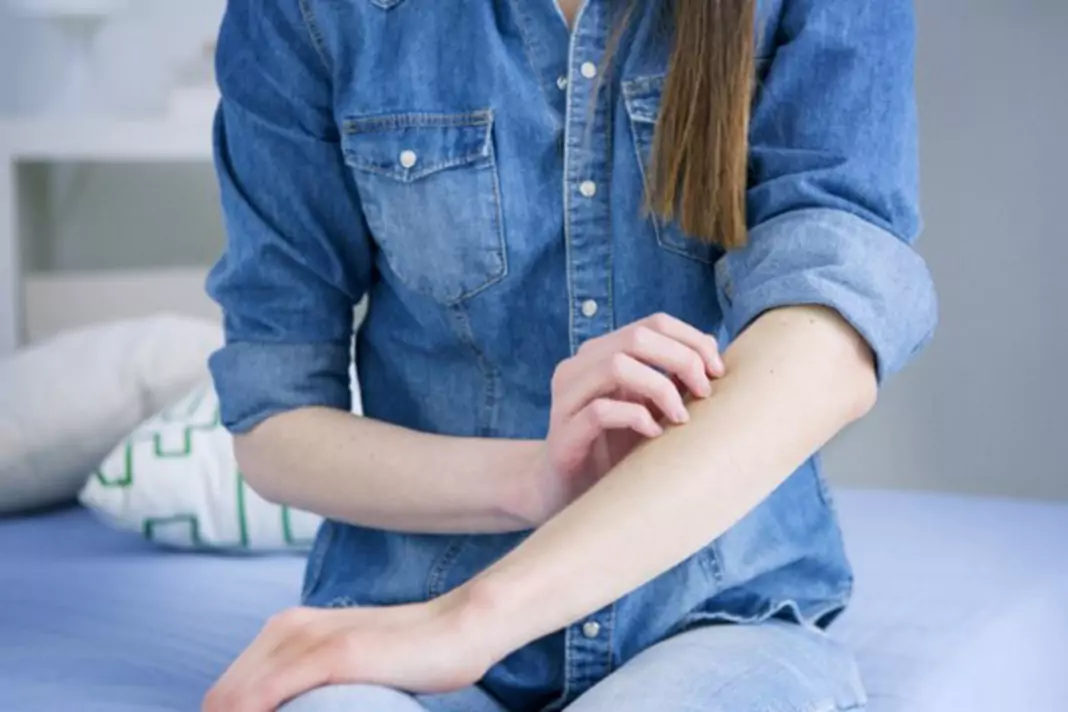 Сърбежи по кожата