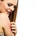 Екземата напада през лятото