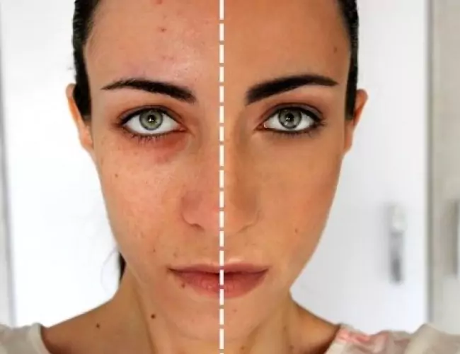 Получете безупречно покритие на фондьотена