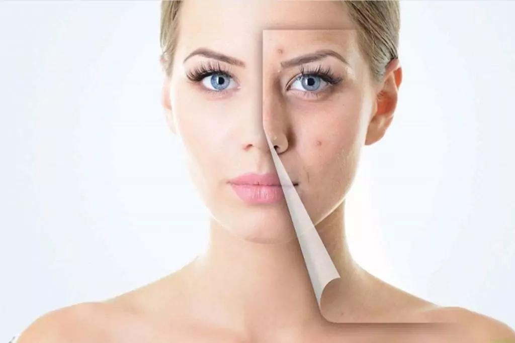 Пъпки Пъпки