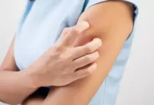 Ако те сърби …