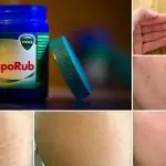 11 неизвестни приложения за евтин мехлем от аптеката