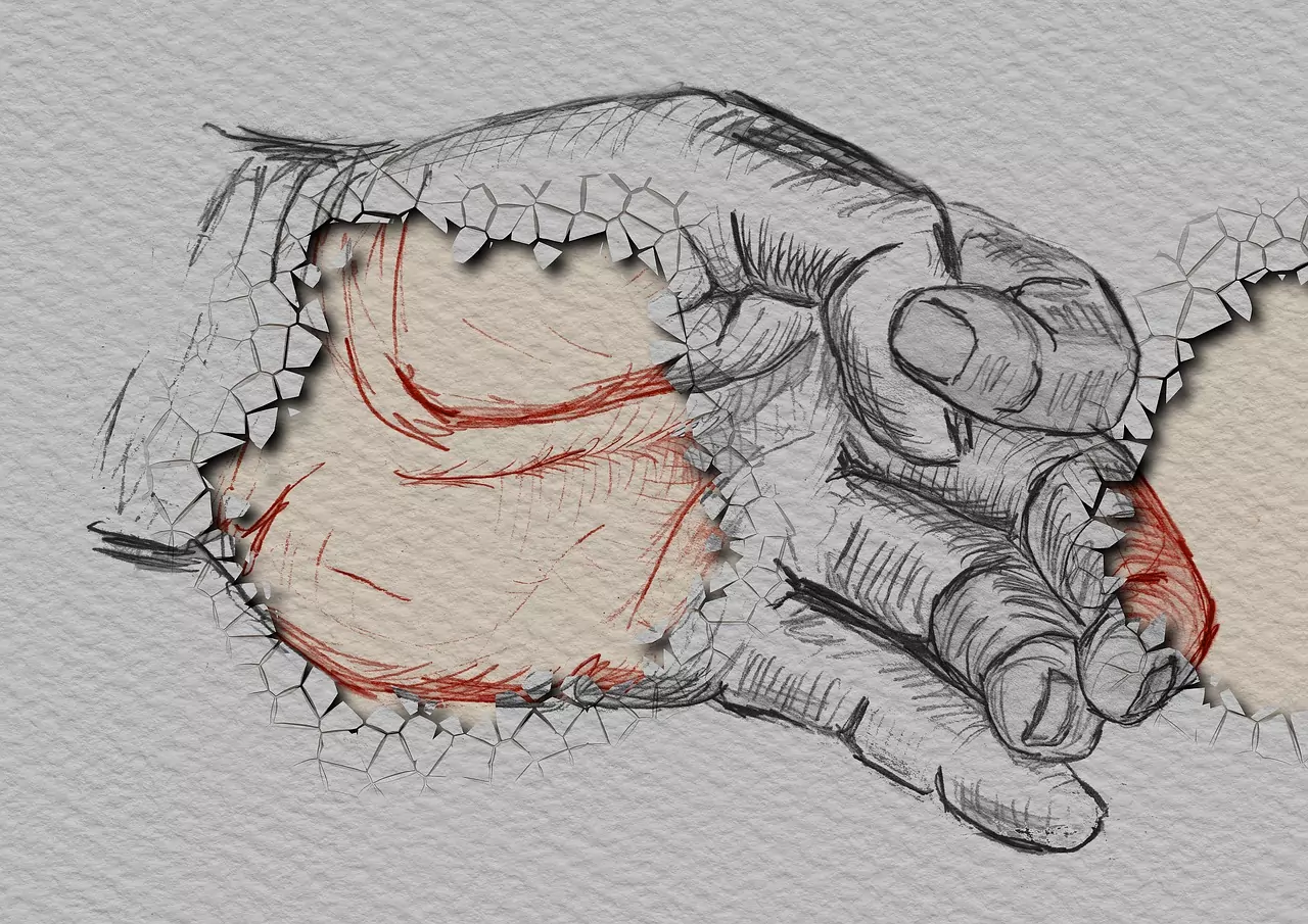 Съновник Счупена ръка