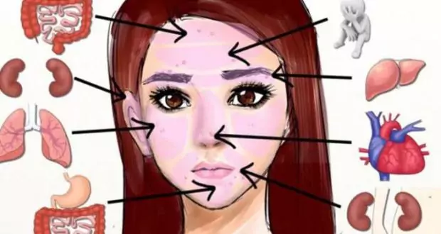 Болестите са изписани на лицето Болестите са изписани на лицето