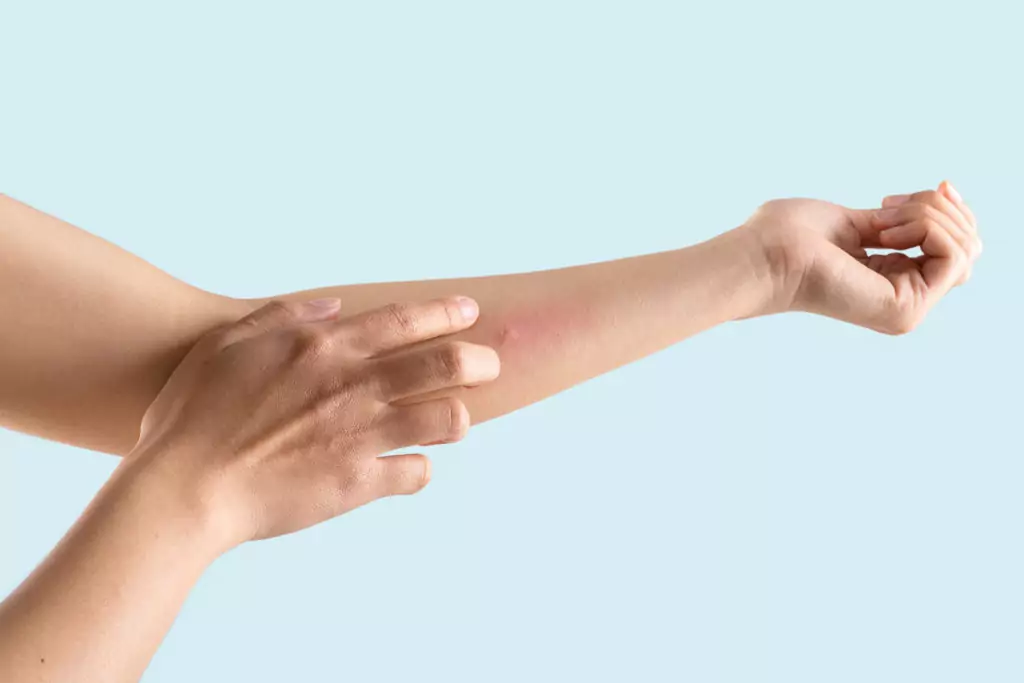 Кожни обриви