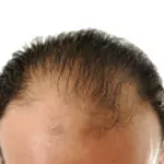 Кои са тайните оръжия за борба с косопада?